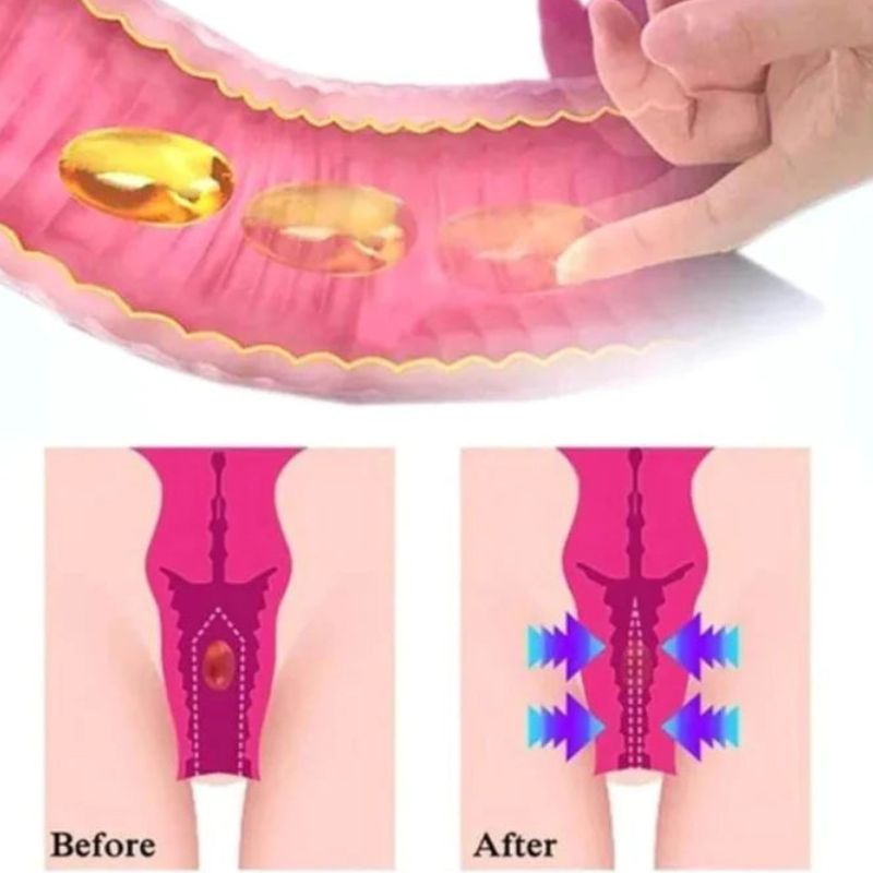 AnnieCare™ - Gélules BioNaturelles de réparation vaginale ( 3 Packs )