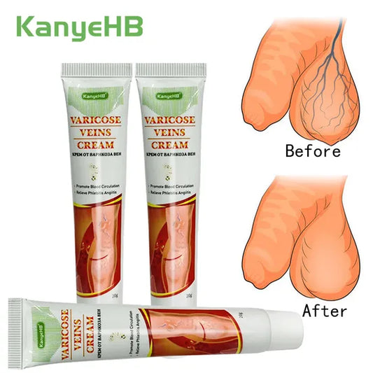 🔥Crèmes pour varices génitales  - Pack 2 Pièces